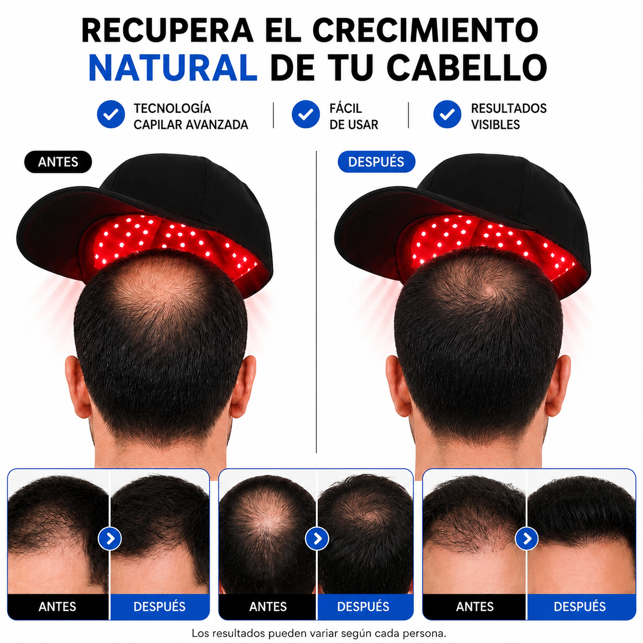 CapiLux – Gorra con Terapia de Luz Roja